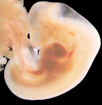 Embrión de 5 semanas